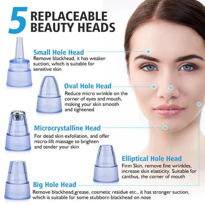 5-in-1 Blackhead remover | Rechargeable